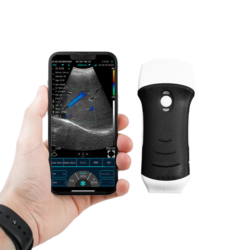 Compact, Portable, Go anywhere Ultrasound Scanner, the InterAktiv Scan Dual Head Hand Held Ultrasound Probe