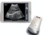 hand Health Portable Wi-Fi Ultrasound equipment