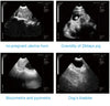 Kaixin MSU3 Vet Digital Mechanical Sector Ultrasound - InterAktiv Health