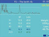 Kaixin MSU3 Vet Digital Mechanical Sector Ultrasound - InterAktiv Health