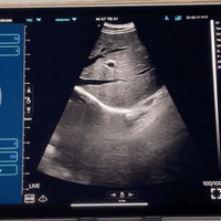 Ultra sound equipment for Ipad