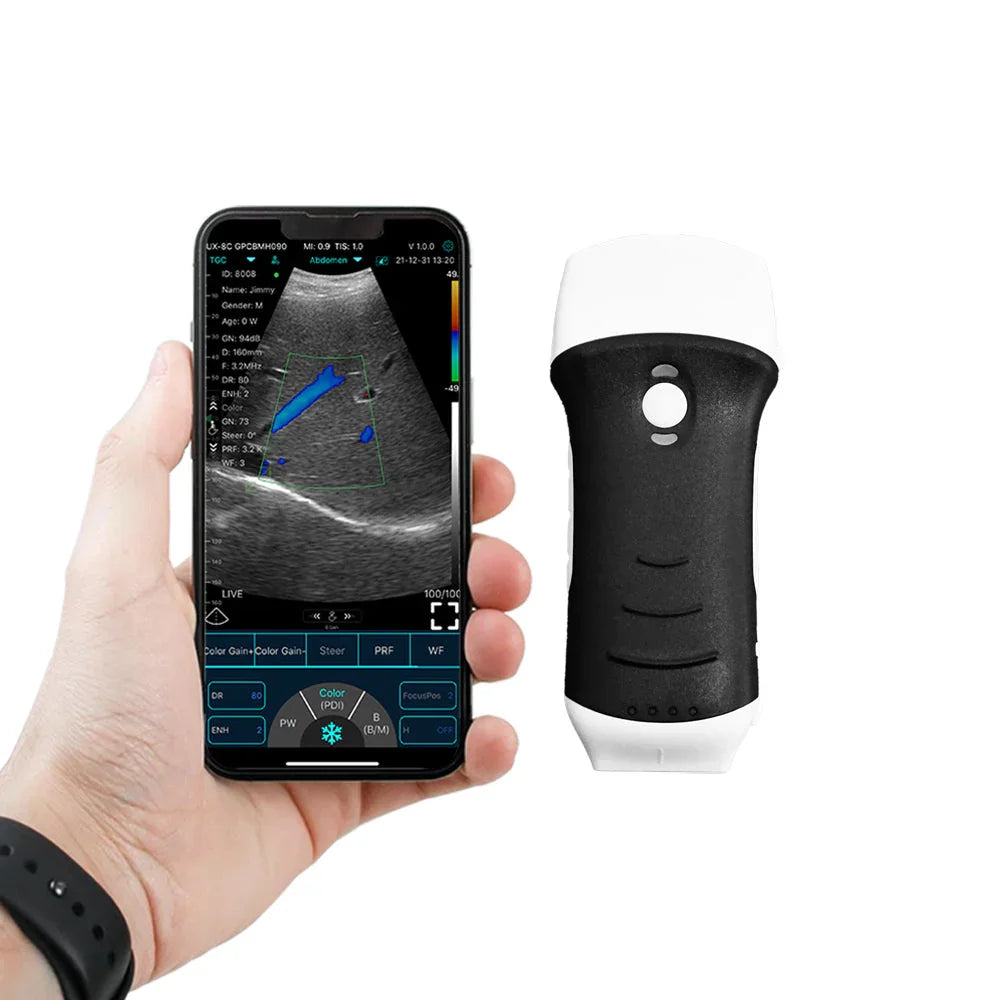 Portable Infared Scanner Portable Ultrasound Scanner | Compact & Wireless Ultrasound Device