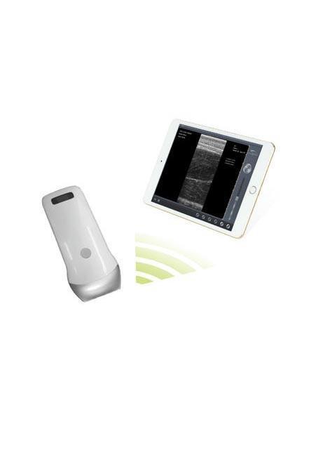 Wireless Ultrasound Scanner using iPad, Tablet or Smartphone bring portability and convenience to Ultrasonography