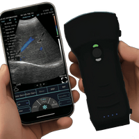 C10TX-PRO Dual Head Convex & Linear Wireless Hand-Held Ultrasound