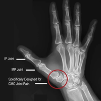 Comfort Cool CMC Thumb Restriction Splint-Left