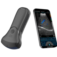 C10MT-Pro USB&Wifi Convex Abdominal Hand-Held Ultrasound - InterAktiv Health