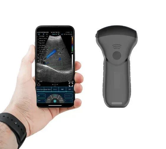 C10MT USB&Wifi Convex Abdominal Hand-Held Ultrasound