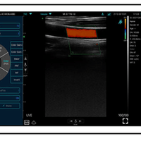 C10MX Pro B&W/Colour Superficial Linear Hand-Held Ultrasound - InterAktiv Health