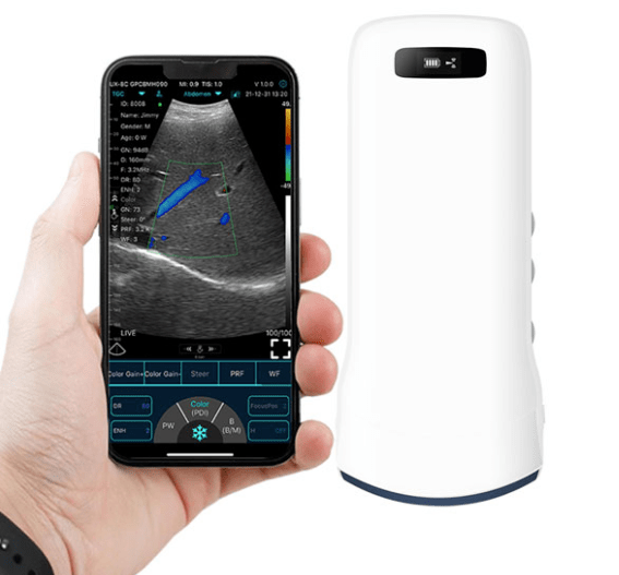 C10RN B&W Abdomen Convex Hand-Held Ultrasound - InterAktiv Health