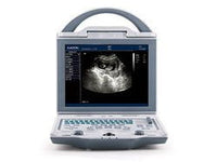 Kaixin KX5600 Veterinary Ultrasound - InterAktiv Health