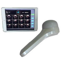 Bladder Scanner 4D array scan for iPad InterAktiv Health