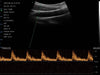 3 in 1 Linear, Convex, Phased Colour Doppler Hand Held Ultrasound with PW - InterAktiv Health