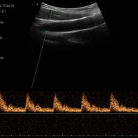 3 in 1 Linear, Convex, Phased Colour Doppler Hand Held Ultrasound with PW - InterAktiv Health