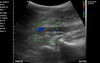 3 in 1 Linear, Convex, Phased Colour Doppler Hand Held Ultrasound with PW - InterAktiv Health