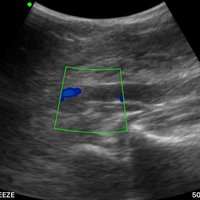 3 in 1 Linear, Convex, Phased Colour Doppler Hand Held Ultrasound with PW - InterAktiv Health