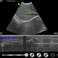 3 in 1 Linear, Convex, Phased Colour Doppler Hand Held Ultrasound with PW - InterAktiv Health