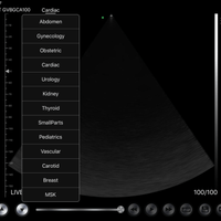 3 in 1 Linear, Convex, Phased Colour Doppler Hand Held Ultrasound with PW - InterAktiv Health