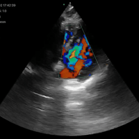 3 in 1 Linear, Convex, Phased Colour Doppler Hand Held Ultrasound with PW - InterAktiv Health