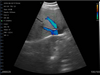 3 in 1 Linear, Convex, Phased Colour Doppler Hand Held Ultrasound with PW - InterAktiv Health