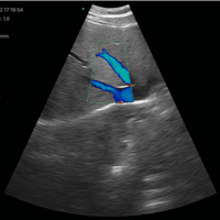 3 in 1 Linear, Convex, Phased Colour Doppler Hand Held Ultrasound with PW - InterAktiv Health