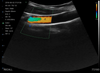 3 in 1 Linear, Convex, Phased Colour Doppler Hand Held Ultrasound with PW - InterAktiv Health