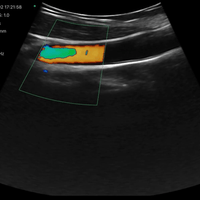 3 in 1 Linear, Convex, Phased Colour Doppler Hand Held Ultrasound with PW - InterAktiv Health