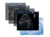 Kaixin KX5600 Veterinary Ultrasound
