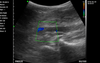 C10MT-Pro USB&Wifi Convex Abdominal Hand-Held Ultrasound - InterAktiv Health