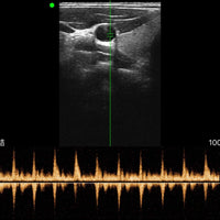 C10MX Pro B&W/Colour Superficial Linear Hand-Held Ultrasound - InterAktiv Health