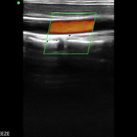 C10MX Pro B&W/Colour Superficial Linear Hand-Held Ultrasound - InterAktiv Health