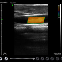 C10MX Pro B&W/Colour Superficial Linear Hand-Held Ultrasound - InterAktiv Health