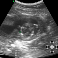 C10RN B&W Abdomen Convex Hand-Held Ultrasound - InterAktiv Health