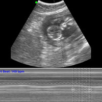 C10RN B&W Abdomen Convex Hand-Held Ultrasound - InterAktiv Health