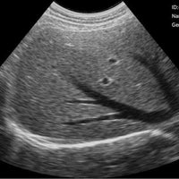 C10RN B&W Abdomen Convex Hand-Held Ultrasound - InterAktiv Health