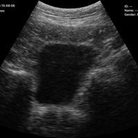 C10RN B&W Abdomen Convex Hand-Held Ultrasound - InterAktiv Health