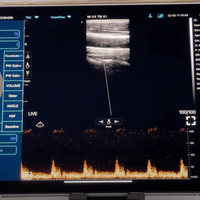 C10TX Dual Head Convex & Linear Wireless Hand-Held Ultrasound - InterAktiv Health