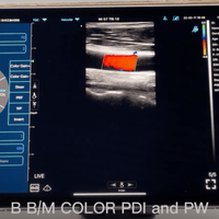 C10TX Dual Head Convex & Linear Wireless Hand-Held Ultrasound - InterAktiv Health