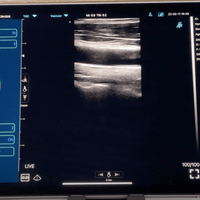 C10TX Dual Head Convex & Linear Wireless Hand-Held Ultrasound - InterAktiv Health