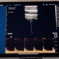 C10TX Dual Head Convex & Linear Wireless Hand-Held Ultrasound - InterAktiv Health