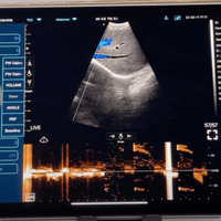 C10TX Dual Head Convex & Linear Wireless Hand-Held Ultrasound - InterAktiv Health