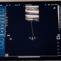 C10TX Dual Head Convex & Linear Wireless Hand-Held Ultrasound - InterAktiv Health