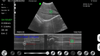 Copy of Convex 3.5/5.0Mhz Colour Doppler Hand Held Ultrasound with PW-Gen4 InterAktiv