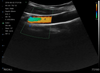 Copy of Convex 3.5/5.0Mhz Colour Doppler Hand Held Ultrasound with PW-Gen4 InterAktiv