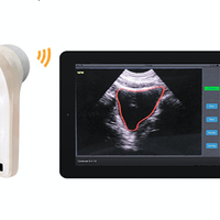 InterAktiv-Scan Hand-Held Bladder Scanner - InterAktiv Health