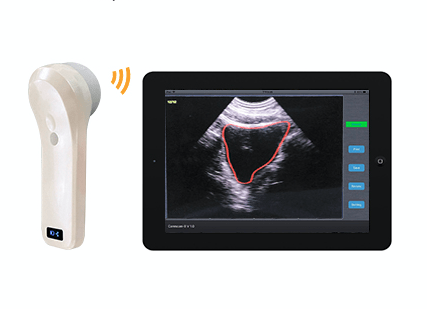 InterAktiv-Scan Hand-Held Bladder Scanner - InterAktiv Health