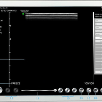 Micro-Convex WiFi Colour Doppler Ultrasound Probe - InterAktiv Health